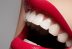 Ce beneficii pot aduce implanturile dentare?