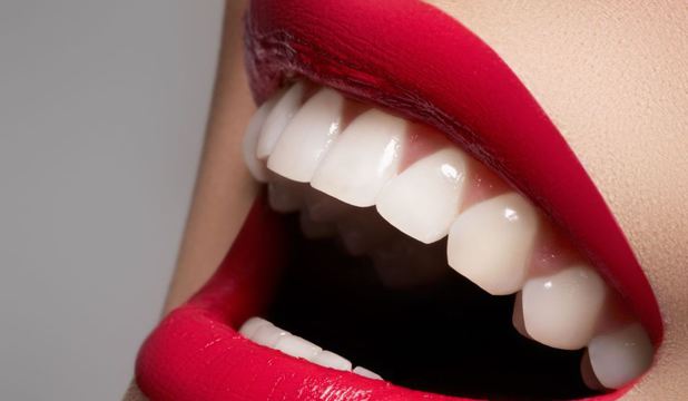 Ce beneficii pot aduce implanturile dentare?