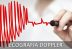 Ce este o ecografie cardiaca doppler pentru inima?
